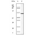 anti-HYAL1 antibody (Hyaluronidase-1) (N-Term)
