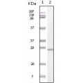 anti-HYAL1 antibody (Hyaluronidase-1) (N-Term)