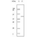anti-HYAL1 antibody (Hyaluronidase-1) (N-Term)