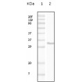 anti-HYAL1 antibody (Hyaluronidase-1) (N-Term)
