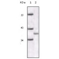 anti-HYAL1 antibody (Hyaluronidase-1) (N-Term)