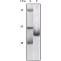 anti-HYAL1 antibody (Hyaluronidase-1) (N-Term)
