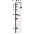 anti-HYAL1 antibody (Hyaluronidase-1) (N-Term)