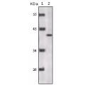 anti-HYAL1 antibody (Hyaluronidase-1) (N-Term)