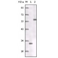 anti-HYAL1 antibody (Hyaluronidase-1) (N-Term)