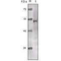 anti-HYAL1 antibody (Hyaluronidase-1) (N-Term)