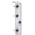 anti-HYAL1 antibody (Hyaluronidase-1) (N-Term)