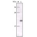 anti-HYAL1 antibody (Hyaluronidase-1) (N-Term)