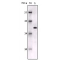 anti-HYAL1 antibody (Hyaluronidase-1) (N-Term)