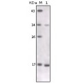 anti-HYAL1 antibody (Hyaluronidase-1) (N-Term)