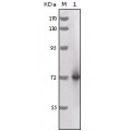 anti-HYAL1 antibody (Hyaluronidase-1) (N-Term)