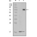 anti-HYAL1 antibody (Hyaluronidase-1) (N-Term)