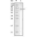 anti-HYAL1 antibody (Hyaluronidase-1) (N-Term)