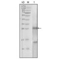 anti-HYAL1 antibody (Hyaluronidase-1) (N-Term)