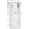 anti-HYAL1 antibody (Hyaluronidase-1) (N-Term)