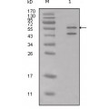 anti-HYAL1 antibody (Hyaluronidase-1) (N-Term)