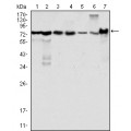 anti-HYAL1 antibody (Hyaluronidase-1) (N-Term)