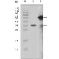 anti-HYAL1 antibody (Hyaluronidase-1) (N-Term)