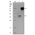 anti-HYAL1 antibody (Hyaluronidase-1) (N-Term)