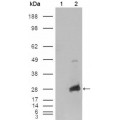 anti-HYAL1 antibody (Hyaluronidase-1) (N-Term)