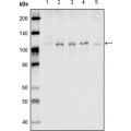 anti-HYAL1 antibody (Hyaluronidase-1) (N-Term)