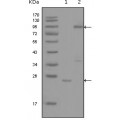 anti-HYAL1 antibody (Hyaluronidase-1) (N-Term)