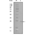 anti-HYAL1 antibody (Hyaluronidase-1) (N-Term)