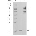 anti-HYAL1 antibody (Hyaluronidase-1) (N-Term)