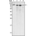 anti-HYAL1 antibody (Hyaluronidase-1) (N-Term)