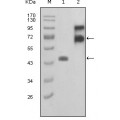 anti-HYAL1 antibody (Hyaluronidase-1) (N-Term)