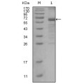 anti-HYAL1 antibody (Hyaluronidase-1) (N-Term)