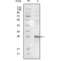 anti-HYAL1 antibody (Hyaluronidase-1) (N-Term)