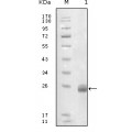 anti-HYAL1 antibody (Hyaluronidase-1) (N-Term)