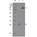 anti-HYAL1 antibody (Hyaluronidase-1) (N-Term)