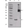 anti-HYAL1 antibody (Hyaluronidase-1) (N-Term)