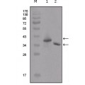 anti-HYAL1 antibody (Hyaluronidase-1) (N-Term)