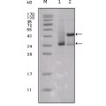 anti-HYAL1 antibody (Hyaluronidase-1) (N-Term)
