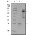 anti-HYAL1 antibody (Hyaluronidase-1) (N-Term)