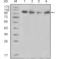 anti-HYAL1 antibody (Hyaluronidase-1) (N-Term)
