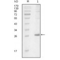 anti-HYAL1 antibody (Hyaluronidase-1) (N-Term)