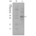 anti-HYAL1 antibody (Hyaluronidase-1) (N-Term)