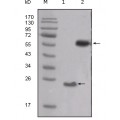 anti-HYAL1 antibody (Hyaluronidase-1) (N-Term)