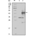 anti-HYAL1 antibody (Hyaluronidase-1) (N-Term)