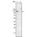 anti-HYAL1 antibody (Hyaluronidase-1) (N-Term)