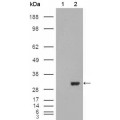 anti-HYAL1 antibody (Hyaluronidase-1) (N-Term)