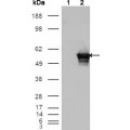 anti-HYAL1 antibody (Hyaluronidase-1) (N-Term)