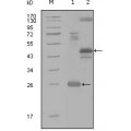 anti-HYAL1 antibody (Hyaluronidase-1) (N-Term)
