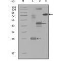 anti-HYAL1 antibody (Hyaluronidase-1) (N-Term)