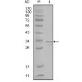 anti-HYAL1 antibody (Hyaluronidase-1) (N-Term)