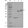 anti-HYAL1 antibody (Hyaluronidase-1) (N-Term)